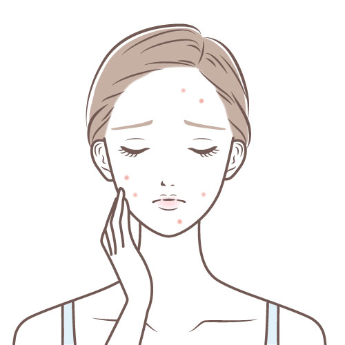 赤ら顔・ニキビ跡の赤み