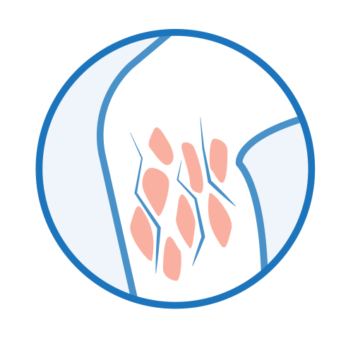 かゆみ・がさがさ・ジクジク